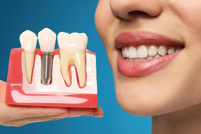 Young woman with beautiful smile and dentist holding educational model of dental implant