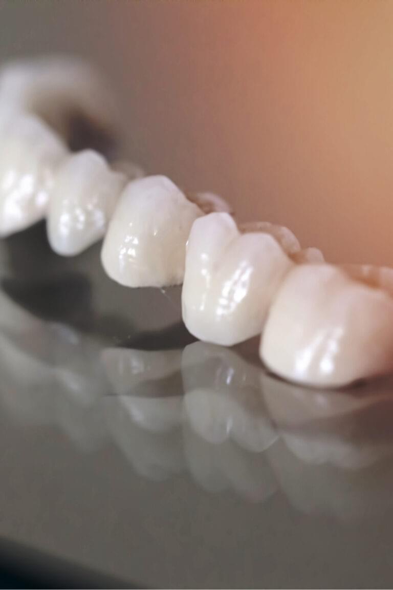Zirconium Porcelain Tooth plate in Dentist Store Photo