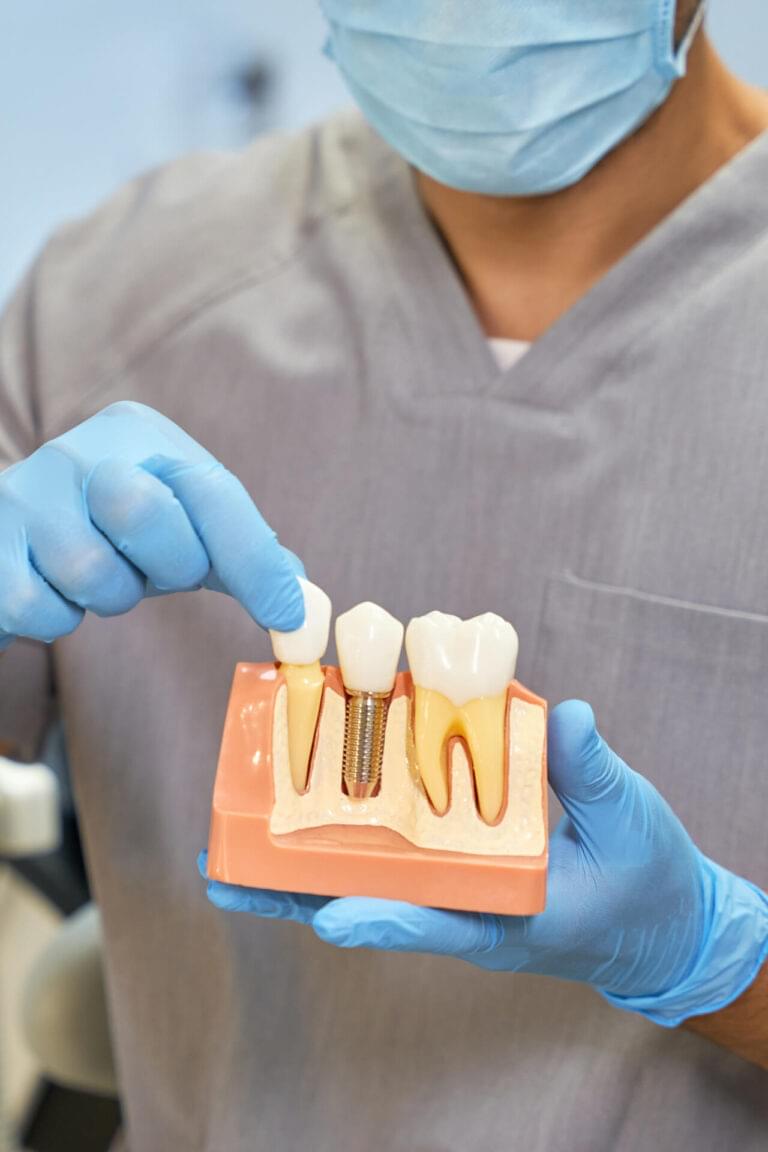 Skillful dental technician showing anatomy of dental implant