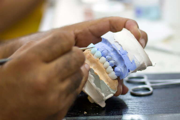 full tooth and whole dental prosthesis construction