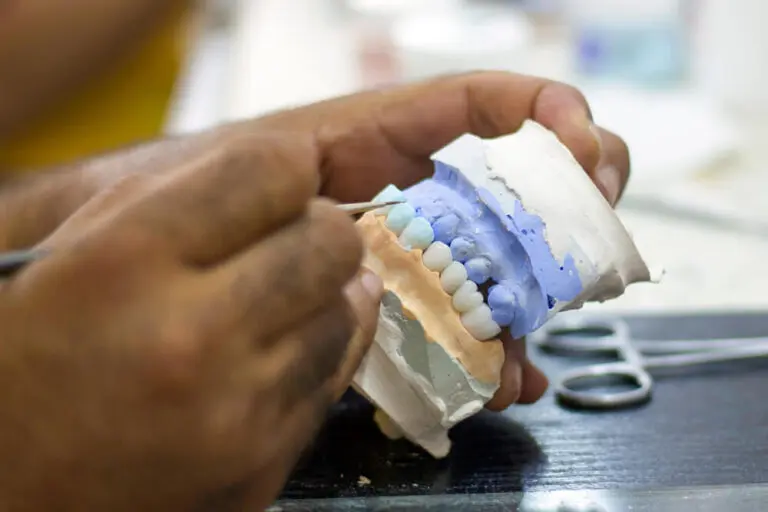 full tooth and whole dental prosthesis construction