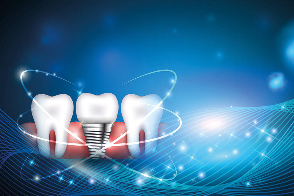 Dental implant and healthy teeth scientific modern design