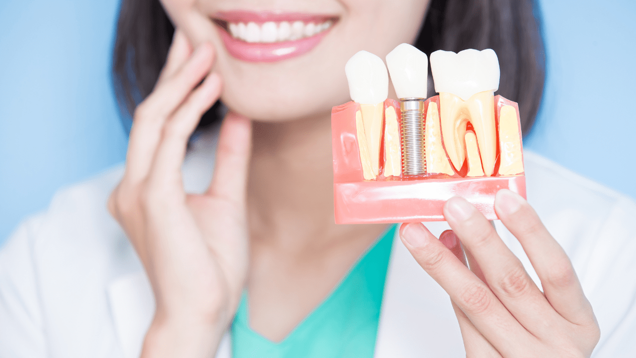 The Dental Implant Process
